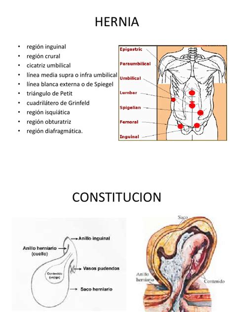 Hernias Abdomen Anatomía Humana