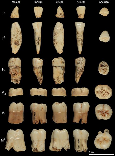 Fossil Teeth Yield Oldest Genetic Material From Extinct Human Species