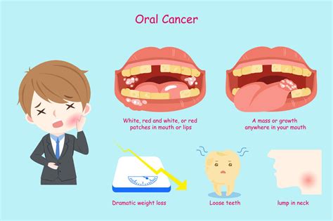 What Are The Risk Factors Of Oral Cancer Your Puyallup Wa General