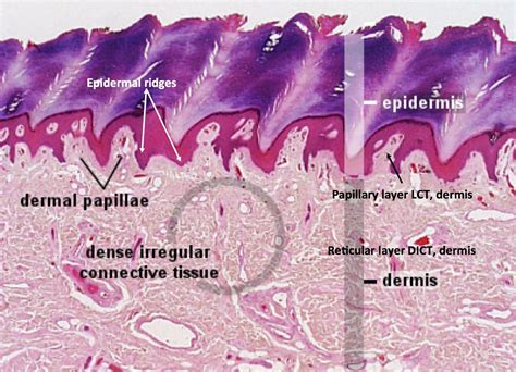 Thick Skin Histology Histology Slides Thick Skin Nursing Tips