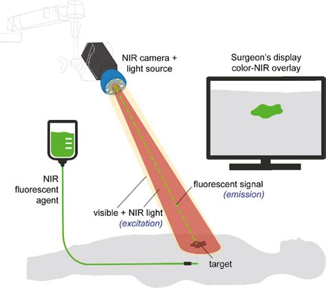 The Basic Principles Of Fluorescence Guided Surgery Nir Fluorescent