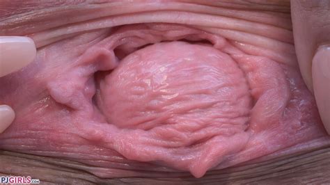 Bdsmm Cervix Prolapse And Pussy Gaping From