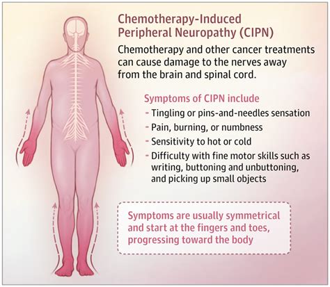 Chemotherapy Induced Peripheral Neuropathy With Images Oncology