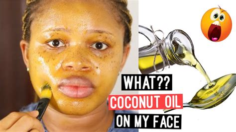 This Happened After Applying Coconut Oil On My Face Youtube