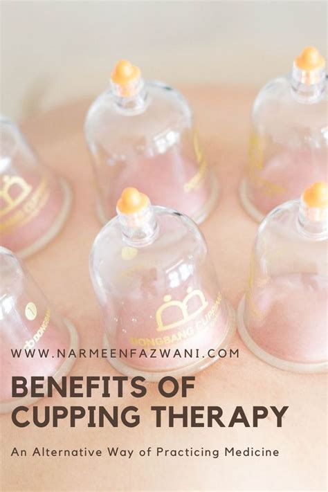 cupping therapy benefits what do you need to know cupping therapy benefits of cupping