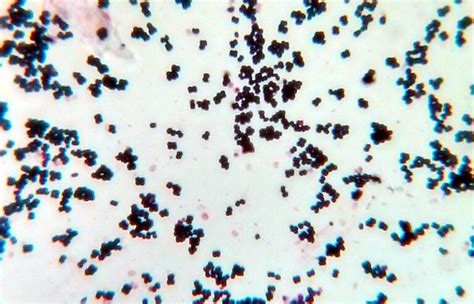 5 Gram Positive Bacteria Examples Detailed Explanations Lambda Geeks