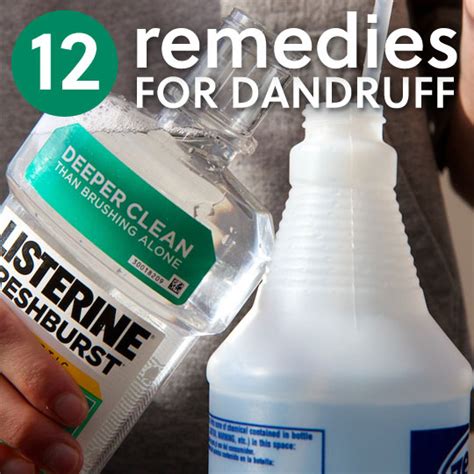 12 Homemade Dandruff Treatments And Shampoos Everyday Roots