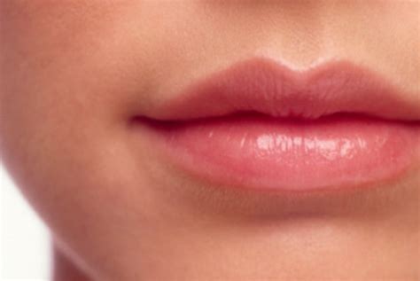 Sebal dengan Bibir Kering? Coba Dulu Cara Alami Ini | Republika Online
