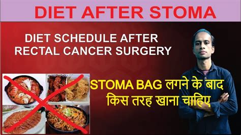 Diet Schedule After Stoma Bag Diet Schedule After Stoma Surgery How