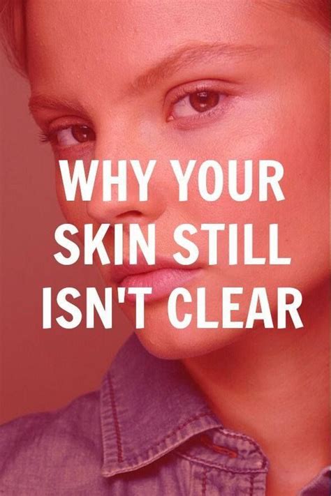 Why Your Skin Isnt Cleara5yp1160554 Bb