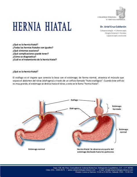 ¿qué Es La Hernia Hiatal Coloproctologia