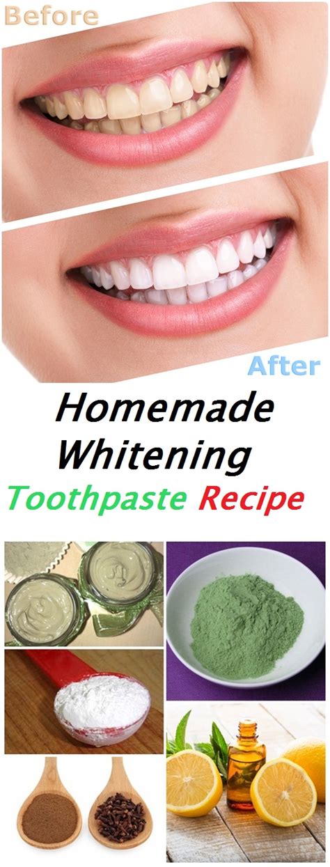 You could try using a diy paste of baking soda, but you'll probably get better results by switching to a toothpaste with sodium bicarbonate. Homemade Whitening Toothpaste Recipe - TOP 5 DIY