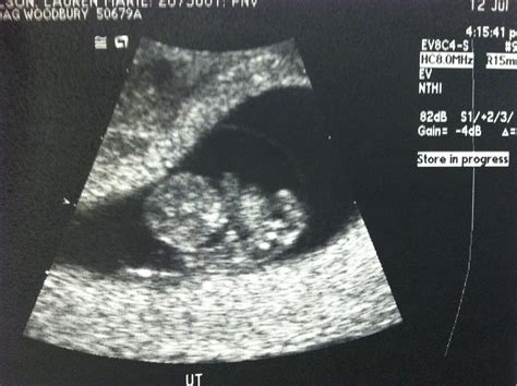 Baby Olson 2 Months And Praying Our First Ultrasound Pic