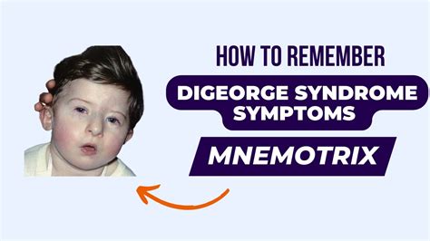 Digeorge Syndrome Symptoms How To Remember Cubital Fossa Mnemonics