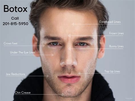 Why Men Should Consider Botox Vanity Male