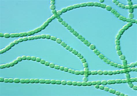 Cyanobacteria Chains Of Cyanobacteria Also Known As Blue Flickr