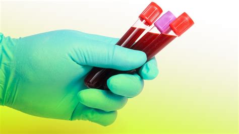 Restricting your diet to ease the work your liver or other blood cleansing organs have to do. This Spleen-On-A-Chip Will Clean Your Blood Like A Machine