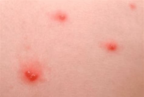 Some of the top rash causes include rashes that develop when the skin is sensitive or allergic to certain substances. Red Spots on Skin Not Itchy, Tiny, Pictures, Petechiae ...