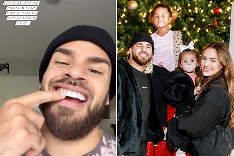 teen mom star cory wharton shocks fans as he reveals his fake tooth has fallen out and shares