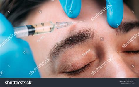 Dermal Filler Injection Face Treatment Antiaging Stock Photo 1942191619