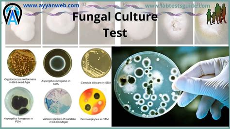 Fungal Culture Lab Tests Guide