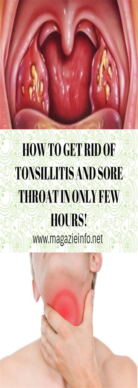 Download 7 Health Tips Sore Throat Remedies Fitness Facts