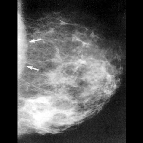Radiologie Leistungsspektrum Digitale Mammographie Regiomed Kliniken