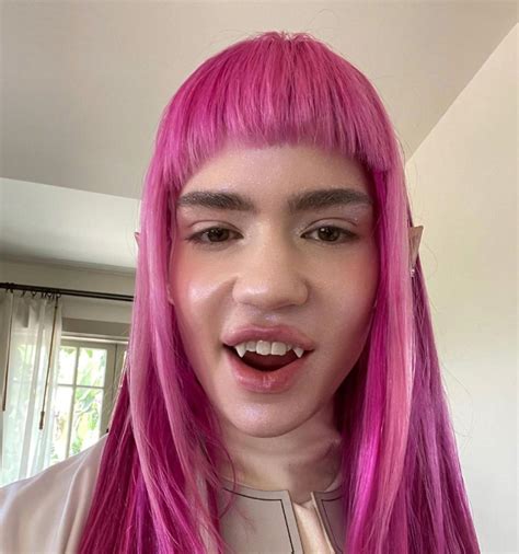 Grimes Shares Pic Of Bandaged Face After Wanting ‘elf Ear Surgery