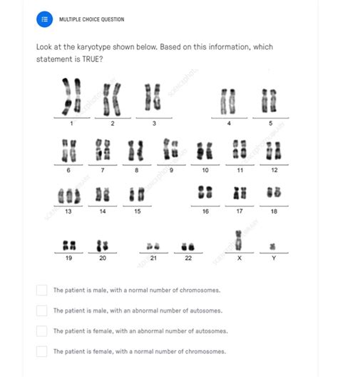 Solved Multiple Choice Question Look At The Karyotype Chegg Hot Sex Picture