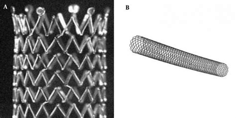 Comparison Of Open Cell Stent And Closed Cell Stent For Treatment Of Central Vein Stenosis Or