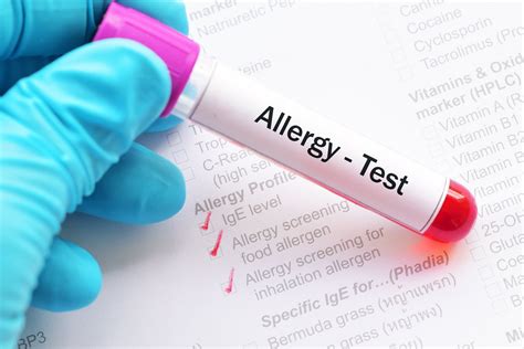 Allergy Testing Singapore Skin Prick Reliable Ige Rast 2022