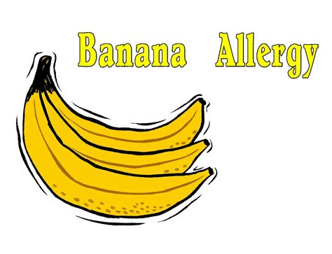 free posters and signs banana allergy
