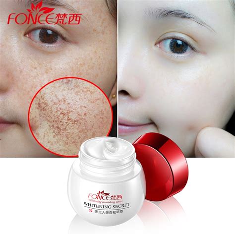 Korean Skin Care Freckle Whitening Cream Strong Reduces Age Spots Fade