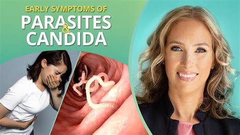 Don’t Ignore These Early Symptoms Of Parasites And Candida In Your Body Dr J9 Live Youtube
