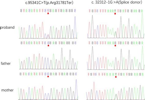 Sanger Sequence Analysis For Validation Of Exome Sequencing Sanger Download Scientific Diagram