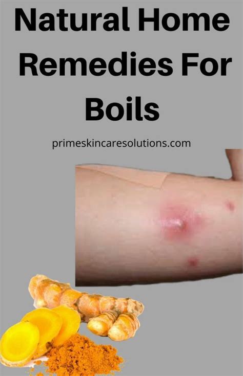 Natural Home Remedies For Boils Home Remedy For Boils Home Remedies