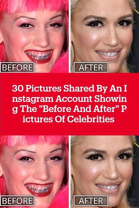 30 Pictures Shared By An Instagram Account Showing The Before And After Pictures Of
