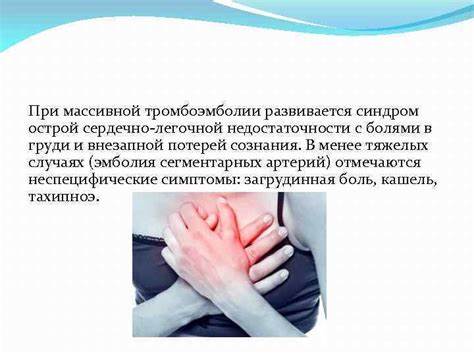Диета при тромбоэмболии легочной Тромбозы и тромбоэмболии при беременности Выполнила студентка 617 Тромбозы и тромбоэмболии при беременности Выполнила студентка 617 Диета при тромбоэмболии легочной