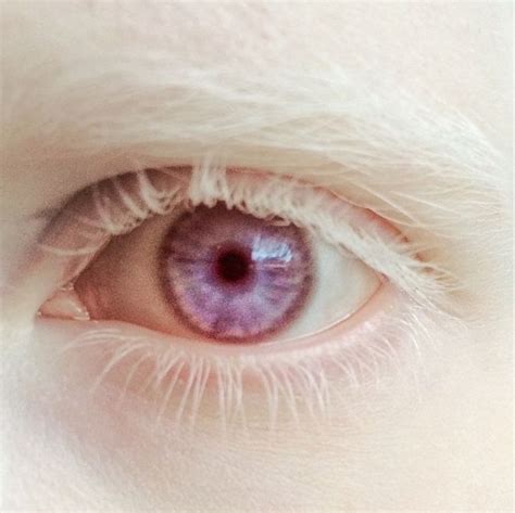 Nastya Zhidkovas Eye Violet Eyes Purple Eyes Modelo Albino