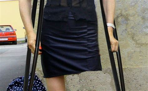 Sak Amputee Women With Wooden Crutches 3 A Gallery On