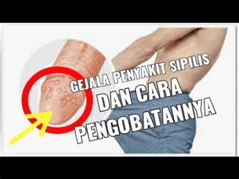 Maybe you would like to learn more about one of these? Apa penyebab terjadinya penyakit raja singa? - YouTube