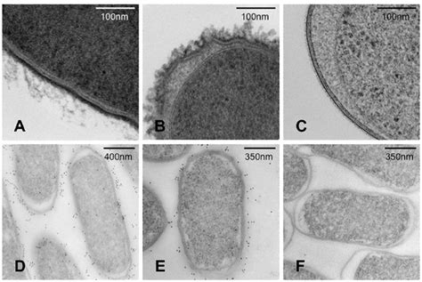 Transmission Electron Microscopy Tem Images Of S Typhi And S