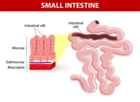Everything You Need To Know About Sibo Small Intestine Bacterial Overgrowth Healthy Gut Company