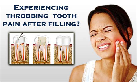 Throbbing Tooth Pain After Filling Health For Best Life