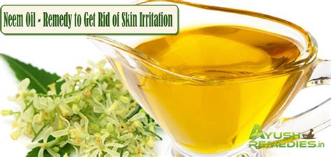 11 Most Effective Home Remedies For Skin Irritation