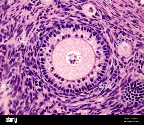 Primordial Follicle Histology