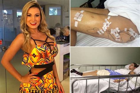 miss bumbum runner up andressa urach almost died when plastic surgery to plump her rear began to