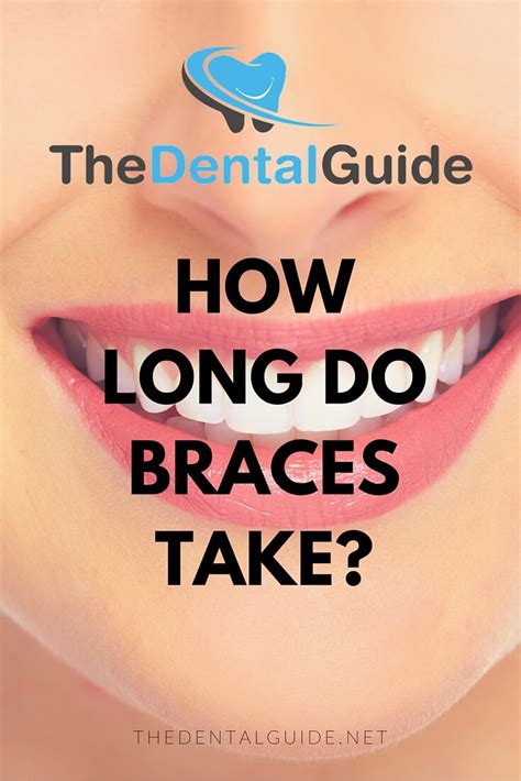 How long do braces take to straighten teeth braces are one of the best solutions for straightening unaligned teeth and having that perfect smile. How Long Do Braces Take? - The Dental Guide