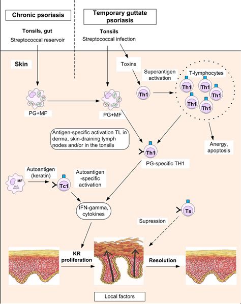 Figure 2 From Model Of Pathogenesis Of Psoriasis Part 1 Systemic
