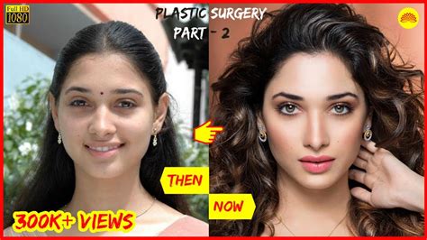 Shocking Plastic Surgery Before And After Of South Indian Actresses